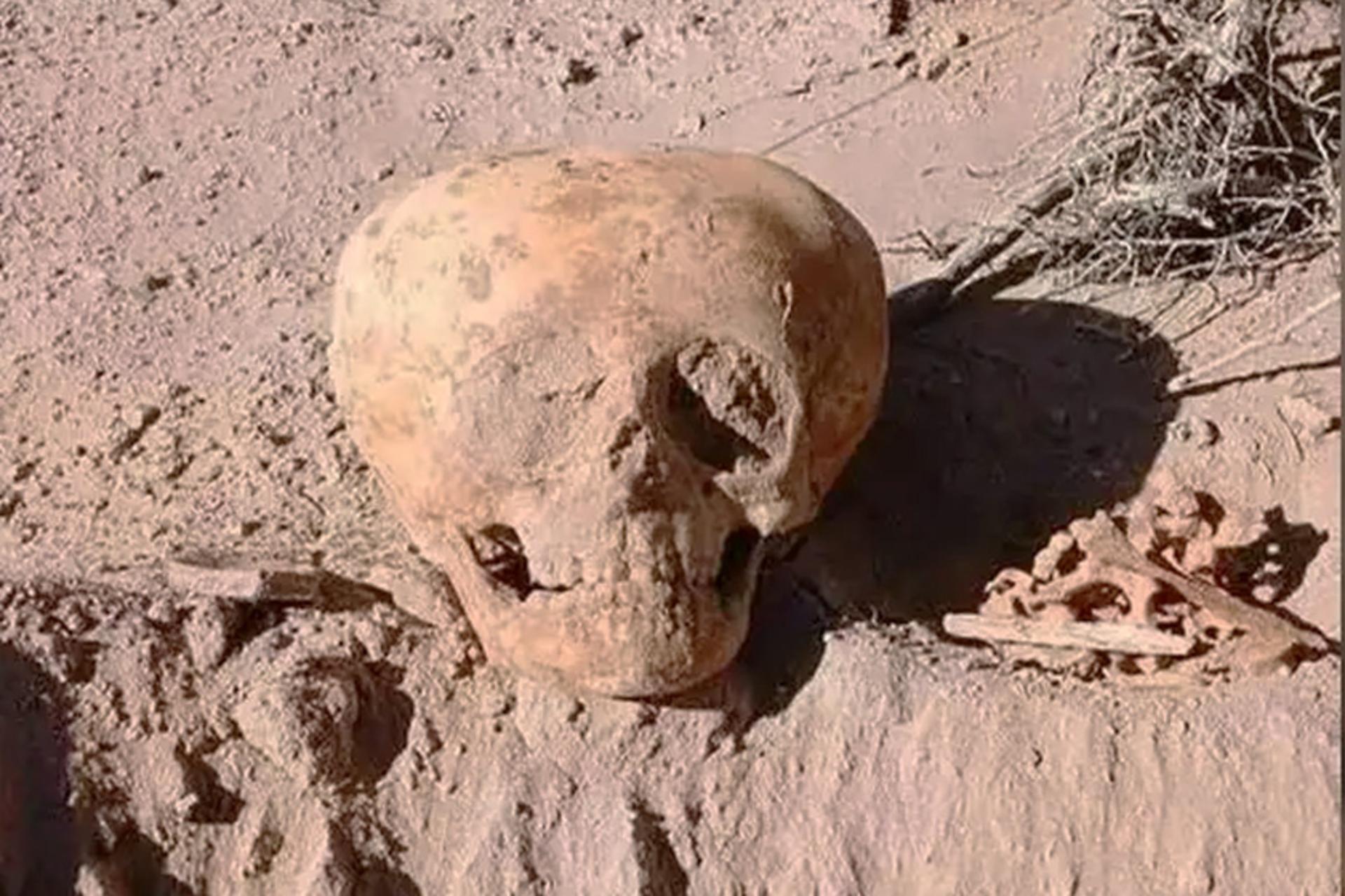 کشف جمجمه مرموز در آرژانتین