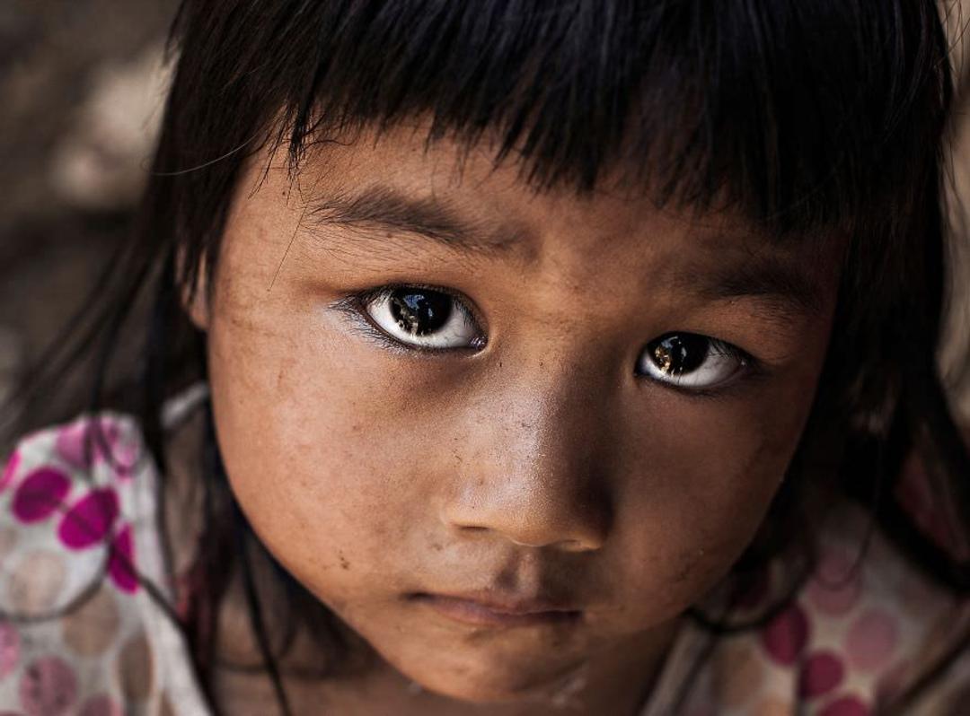 2015-08-eyes-are-windows-of-the-soul12__880