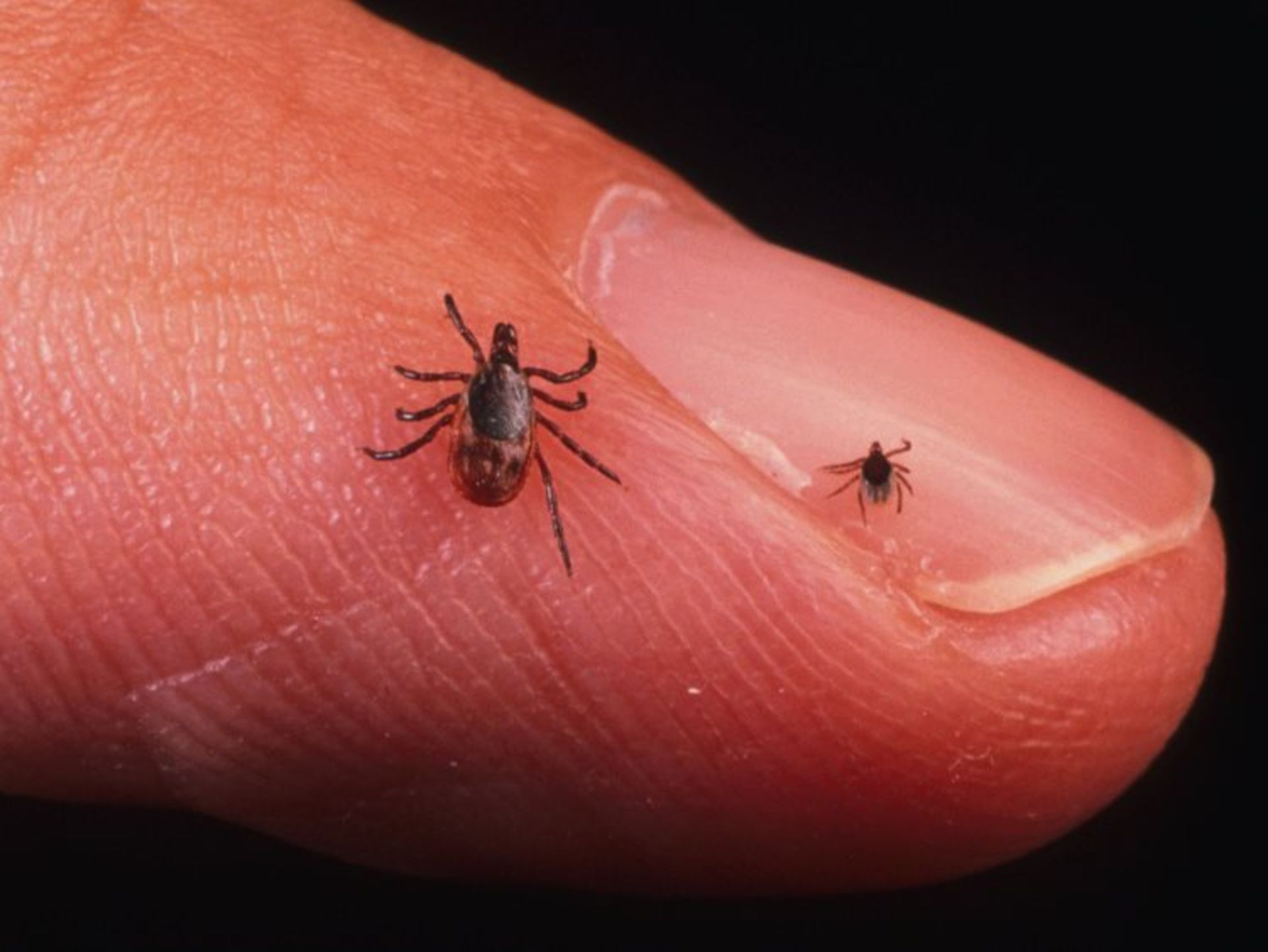 2015-10-deer-tick-size-scale-finger-adult-nymph-lyme-disease-getty-images
