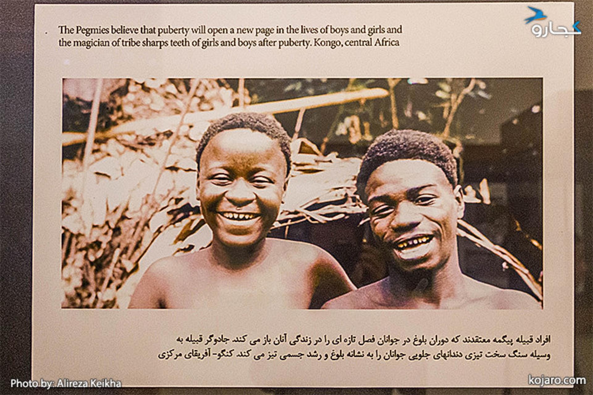 افراد قبیله پیگمه معتقدند که دوران بلوغ در جوانان فصل تازه‌ای در زندگی آنان باز می‌کند. جادوگر قبیله به‌وسیله سنگ سخت تیزی دندان‌های جلویی جوانان را به نشانه بلوغ و رشد جسمی تیز می‌کند. کنگو، آفریقای مرکزی