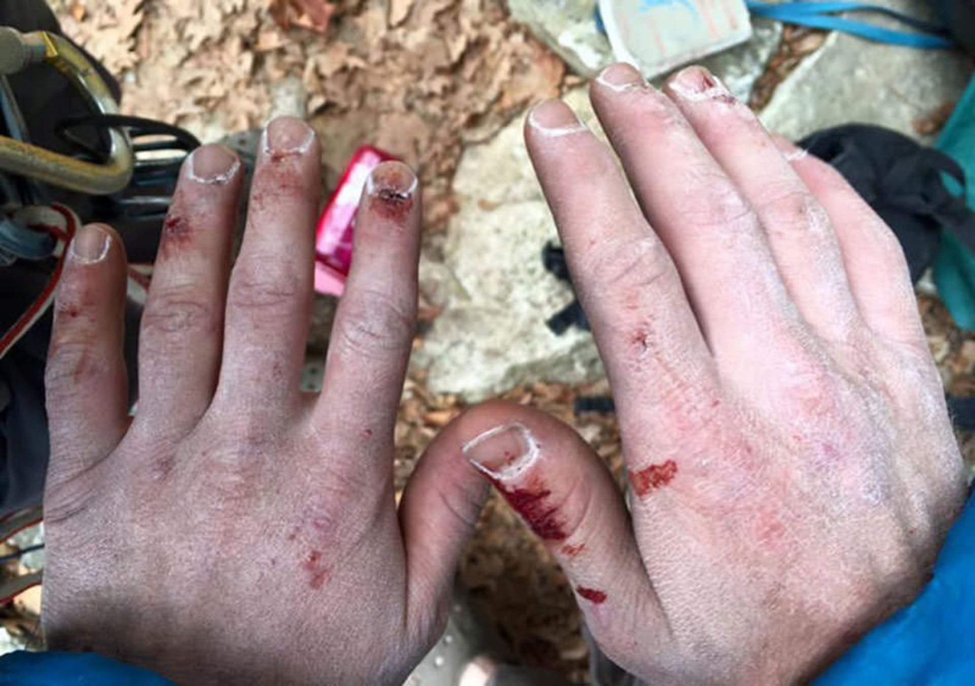 مراقبت از پوست