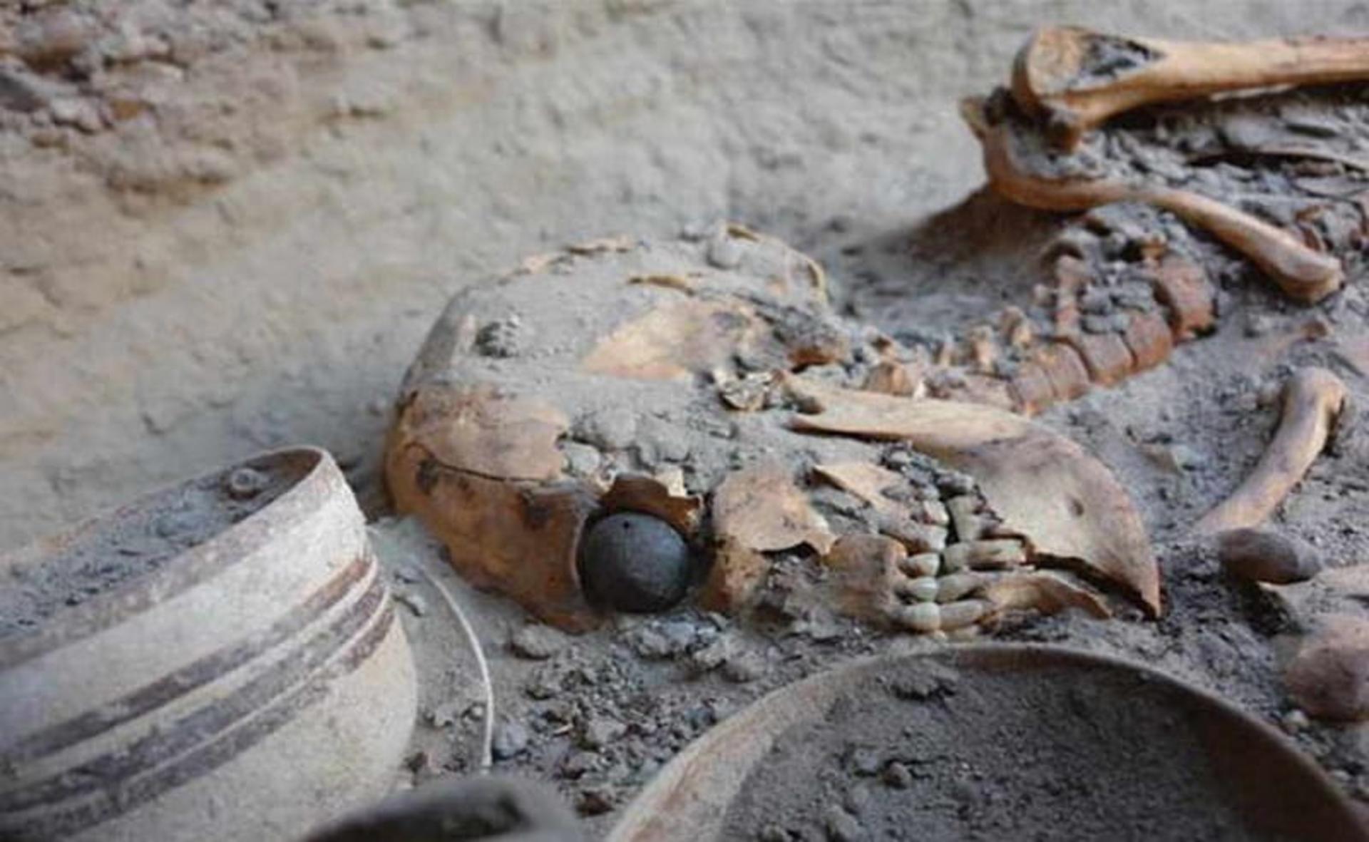 اولین چشم مصنوعی جهان در میان بقایای اسکلت در شهر سوخته