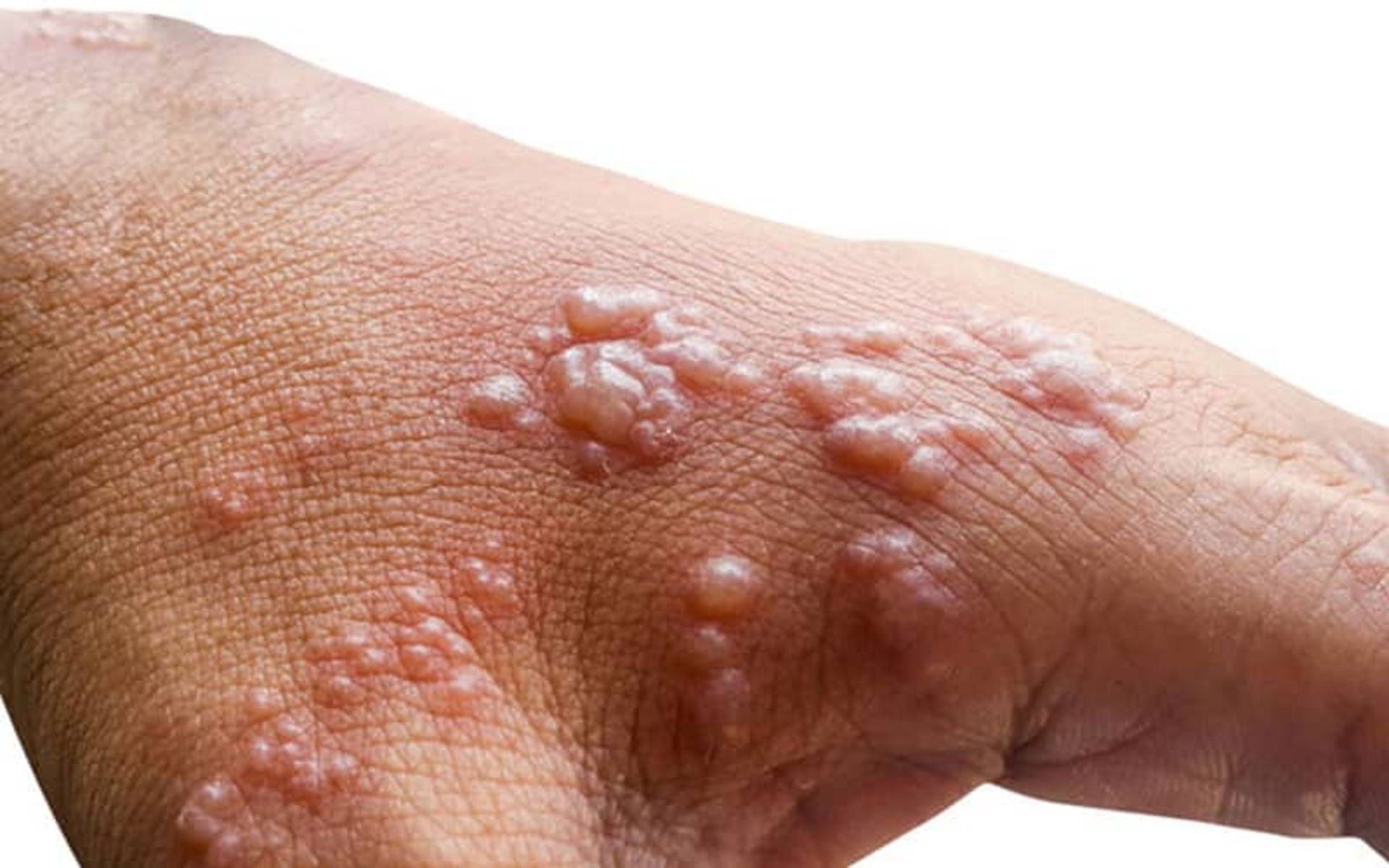 2022-7-17cc3fde-b86a-4209-a8e8-5cac35c9522a