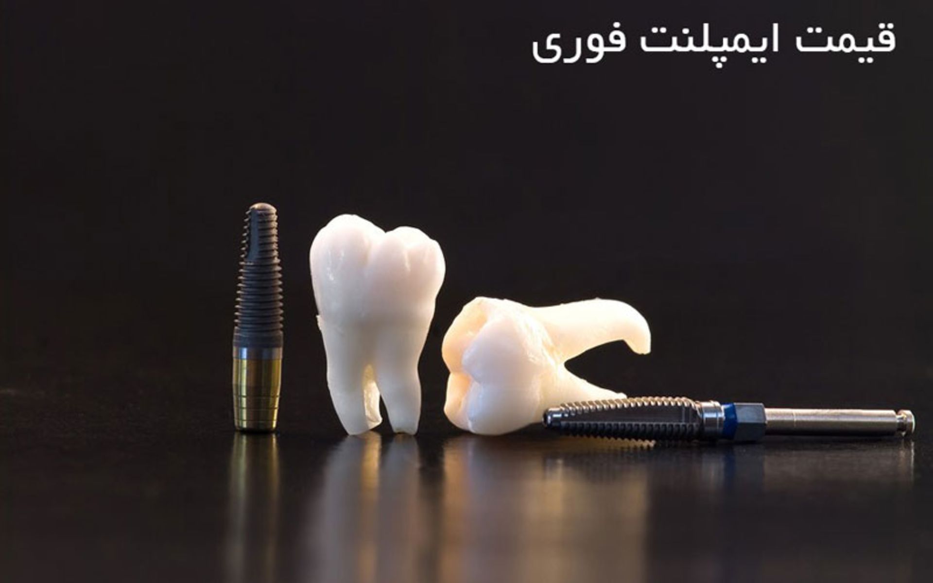قیمت ایمپلنت فوری