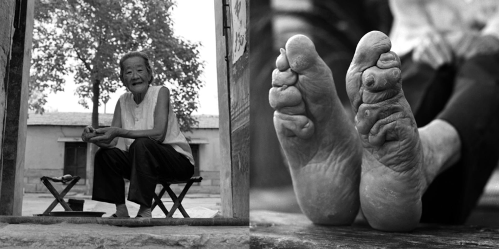 پیرزن چینی با پاهای نیلوفری