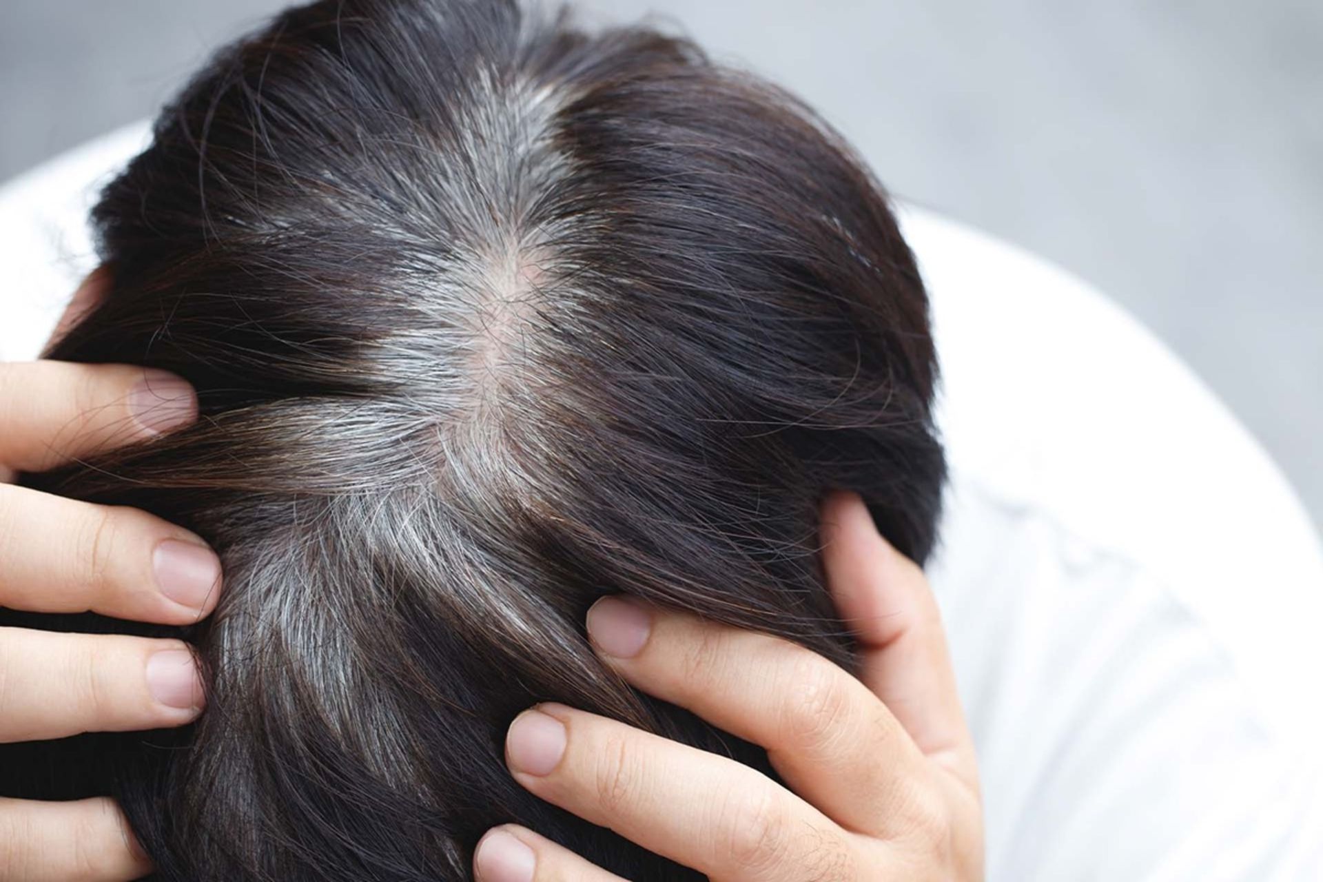 آیا استرس واقعا موها را سفید می‌کند؟