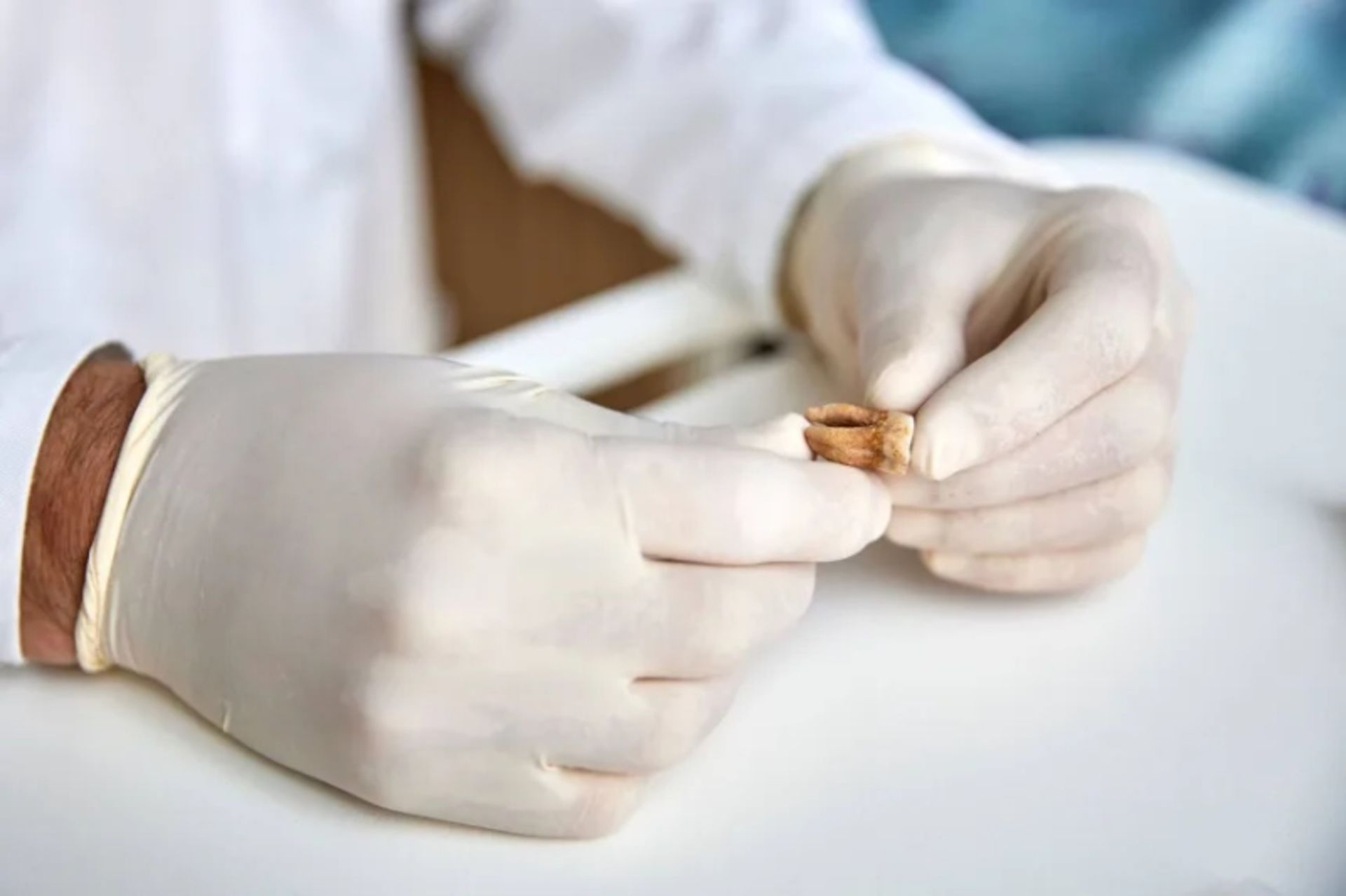 بررسی دندان سرباز ارتش ناپلئون بناپارت